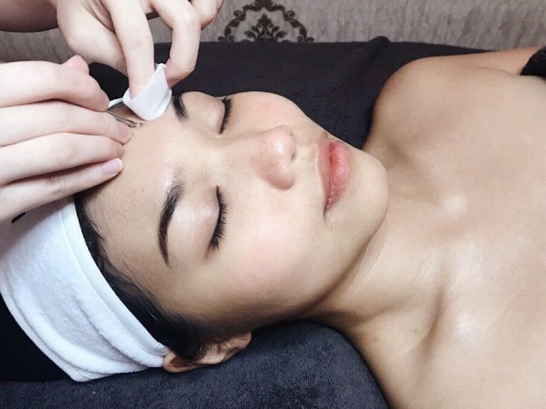 extraction facial 768x575